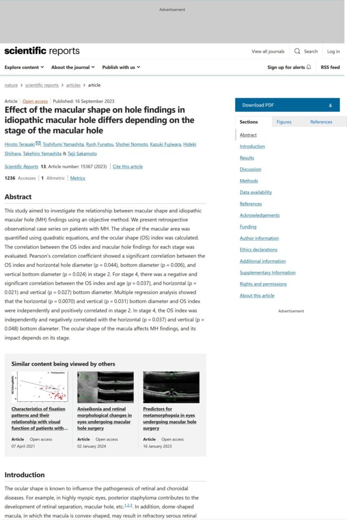 Effect of the macular shape on hole findings in idiopathic macular hole differs depending on the stage of the macular hole